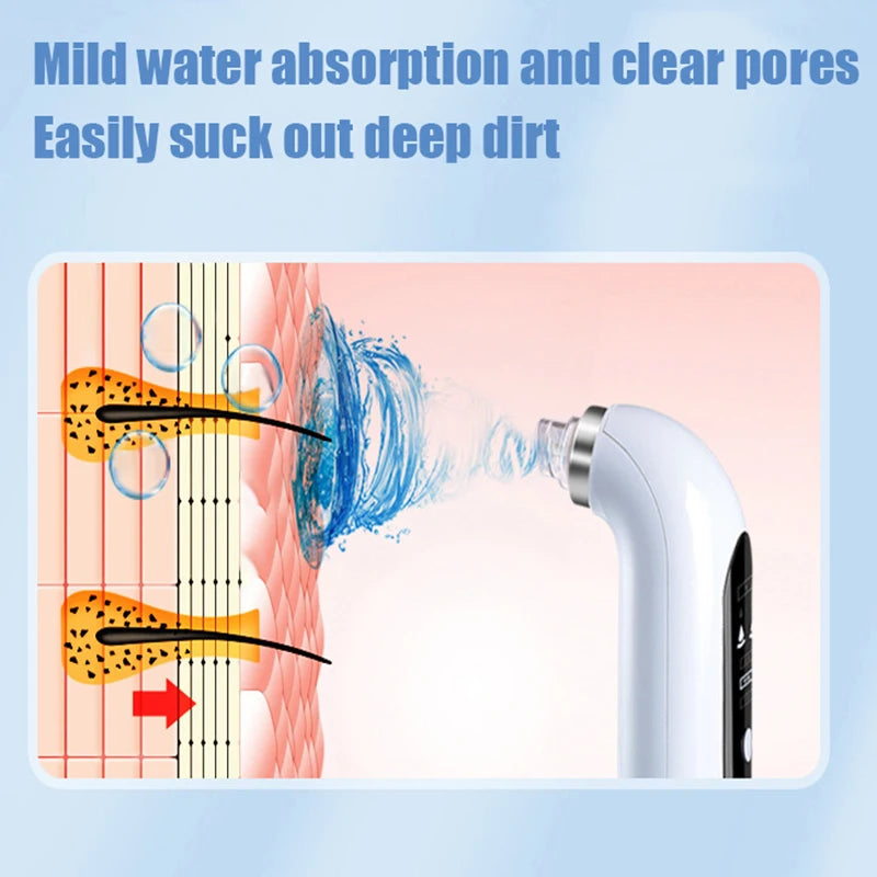 Blackhead Pore Vacuum & Cleanser