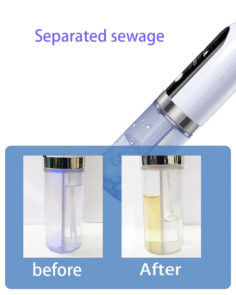 Blackhead Pore Vacuum & Cleanser