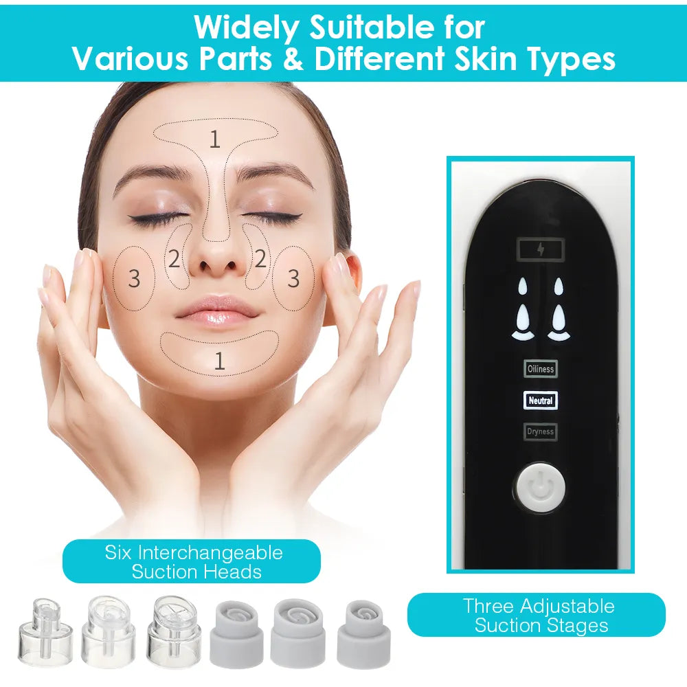 Blackhead Pore Vacuum & Cleanser