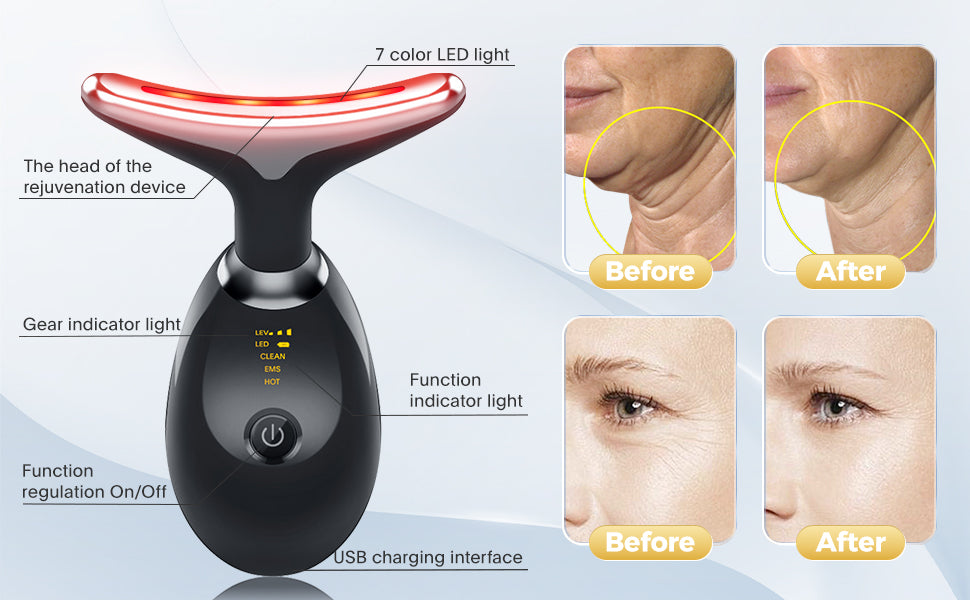 LED Photon Face Beauty EMS Device
