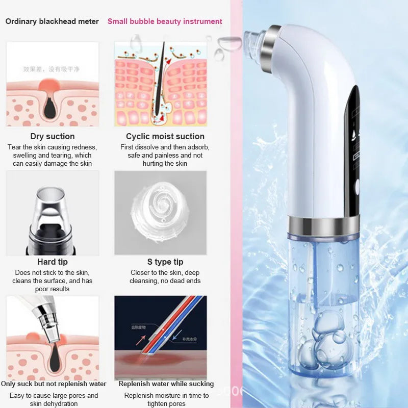 Blackhead Pore Vacuum &amp; Cleanser