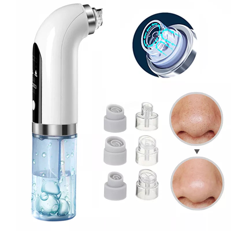 Blackhead Pore Vacuum &amp; Cleanser