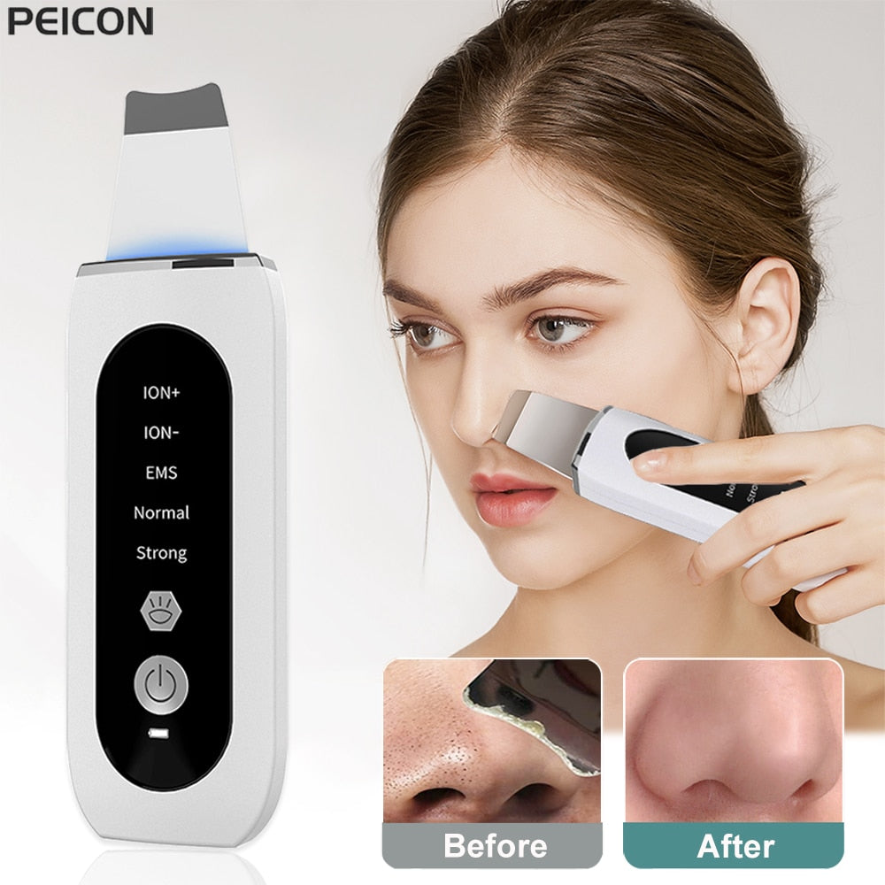 Ultrasonic Deep Skin Scrubber