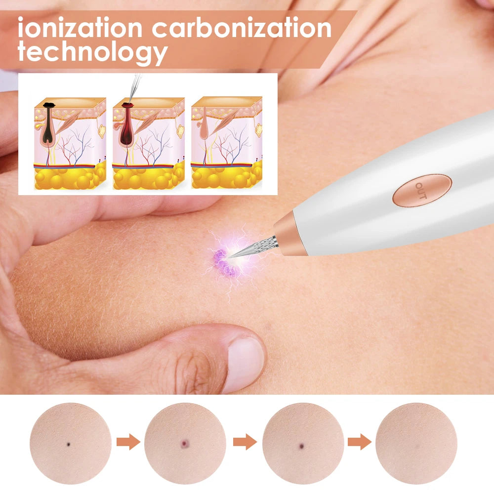 Mole &amp; Dark Spot Removal Pen