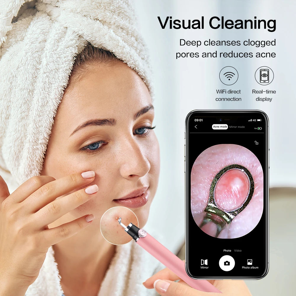 HD Camera Pore Visual Tool